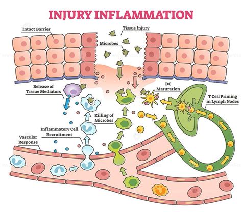 Description Injury Inflammation Process As Body Response To Microbes