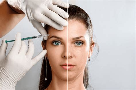 Could Botox Actually Help Depression Saber Plastic Surgery