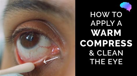 How To Apply A Warm Compress And Clean The Eye Eye First Aid Osce
