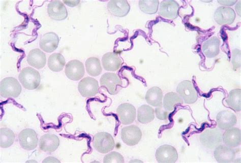 Key difference between pest and an insect. Difference Between Giemsa Stain and Wright Stain | Compare ...