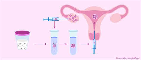 Https Reproduccionasistida Org El Proceso De La Fecundacion In Vitro Como Se Hace Una