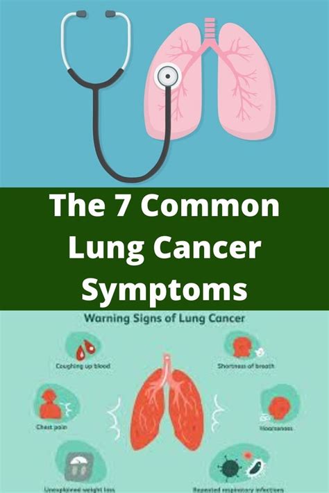 Shutterstock lung cancer is the second most common cancer in the united states. The 7 Common Lung Cancer Symptoms