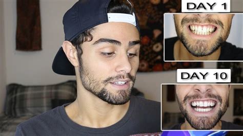Check spelling or type a new query. TESTING CREST 3D WHITE STRIPS! FULL 10 DAY REVIEW | Konnor ...