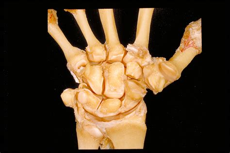 Wrist | The eight small bones of the complex wrist joint are… | Flickr