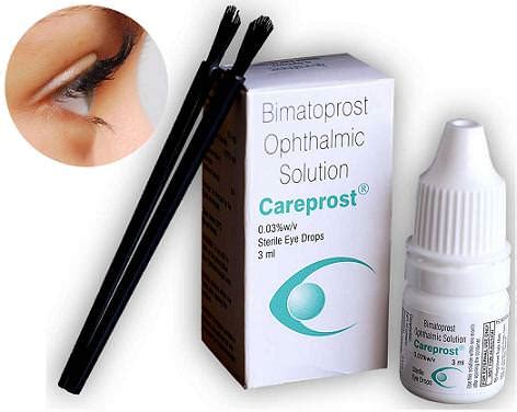 Allergan is currently studying the safety and efficacy of a new formulation of bimatoprost for use specifically as a topical hair loss treatment for common baldness (androgenetic alopecia) in both men and women. Bimatoprost Eye Drops - A Total Solution For Lesser Eyelashes
