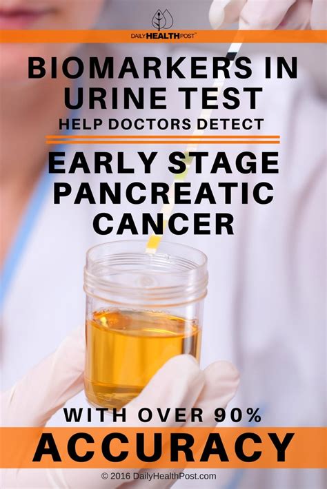 Large breed dogs and siamese cats may be predisposed. Biomarkers In Urine Test Help Detect Early Pancreatic Cancer