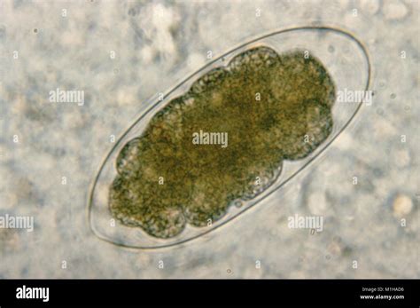 Photomicrograph Of An Egg From The Trichostrongylos Species A Parasite