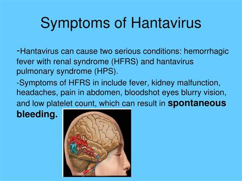 You become infected primarily by breathing air infected with hantaviruses that are shed in rodent urine and droppings. hantavirus: Hantavirus Symptoms