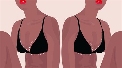 Breast Reduction Surgery Guide What To Expect From Cost To Recovery
