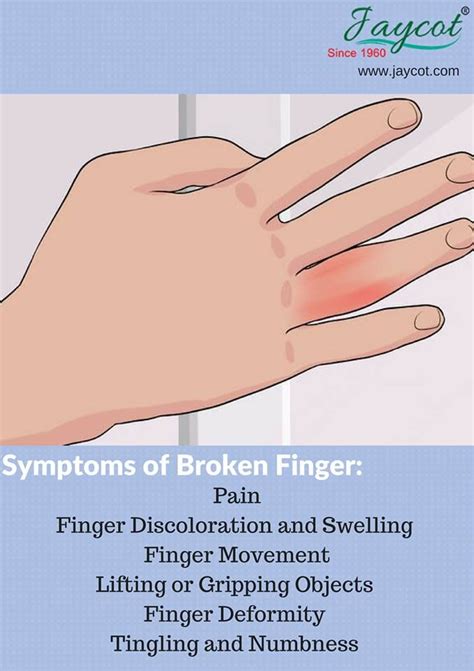Check Out The Symptoms Of Broken Finger Broken Finger Symptoms