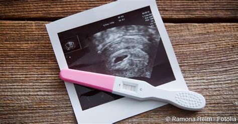 Lesen sie 18 schwangerschaftsanzeichen von übelkeit bis zum ausbleiben der. Schwangerschaftstest: Ab wann er aussagekräftig ist ...