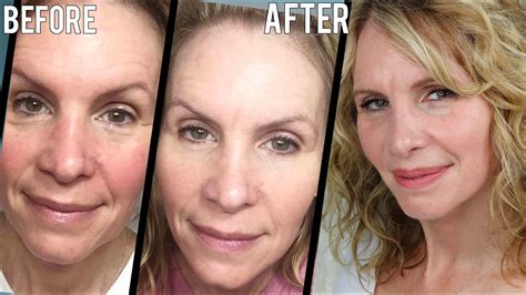 55 year old woman 7 week curology skincare results of fine lines wrinkles and uneven skin