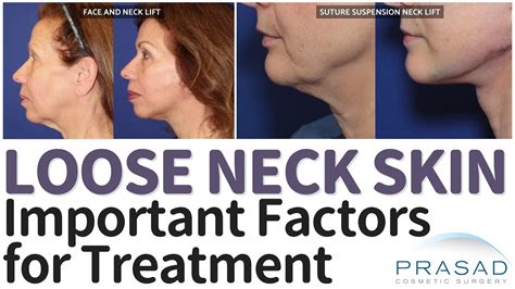 Loose Neck Skin Surgical And Non Surgical Treatment Options Youtube