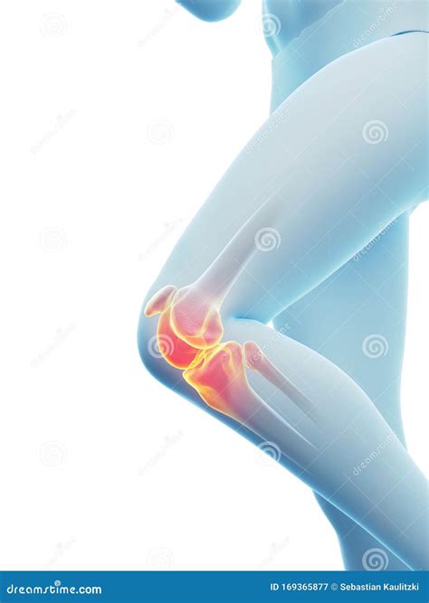 A Woman Having A Painful Knee Stock Illustration Illustration Of Ache