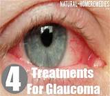 Neovascular Glaucoma Treatment