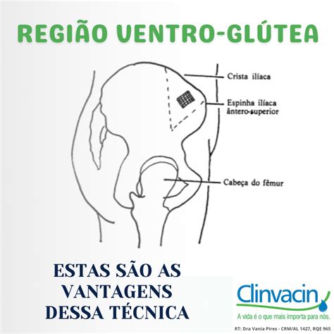 Dorso Glúteo E Ventro Glúteo