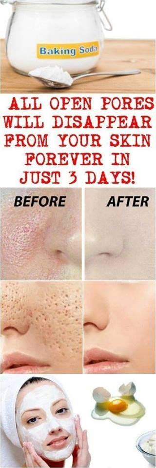 How To Get Rid Of Enlarged Pores Naturally Skin Treatments Skin Care