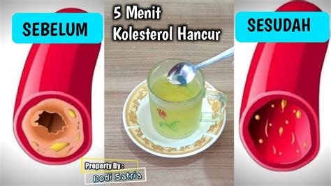 Sebagian besar kolesterol diproduksi di organ hati, dan. Kolesterol Hancur Dalam 5 Menit,Darah Tinggi Sembuh l Obat ...
