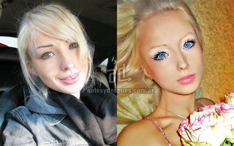 The Real Face Of Human Barbie Dolls Before And After Photos