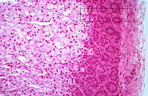 Adrenal: Adrenal Zona Fasciculata