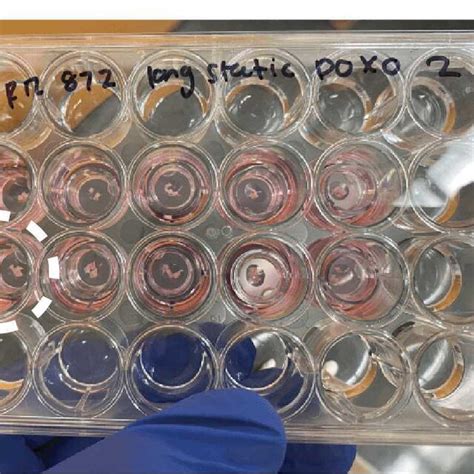 Ovarian Explant Culture Set Up Ovarian Tissue Pieces Are Loaded In Download Scientific Diagram