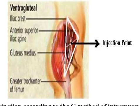 figure 2 from using ventrogluteal site in intramuscular injections is a priority or a n