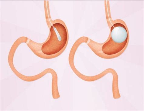 Simple Science: How to Make a Volcano with Kids