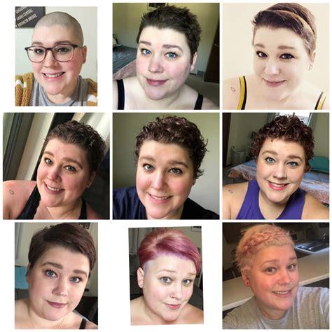 Hair Growth Progression Over 6 Months : Hair