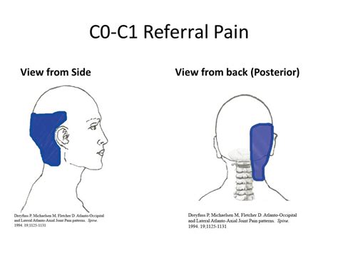 Headaches Arising From Atlanto Occipital Joint Csc