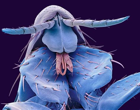 Everyday Items Under A Microscope 27 Pics