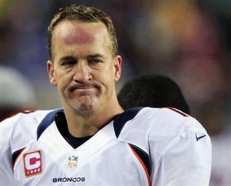 What Is Wrong With Peyton Mannings Forehead Barnorama