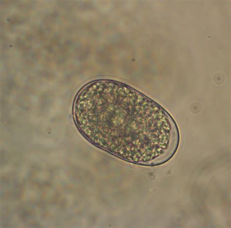 Necator Americanus Scheda Parassitologica Di Microbiologia Italia