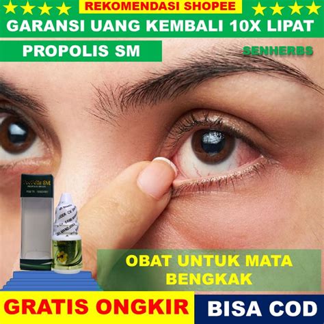 Jual Obat Mata Bengkak Obat Mata Bengkak Obat Mata Bintitan Obat Mata Kalazion Obat Mata