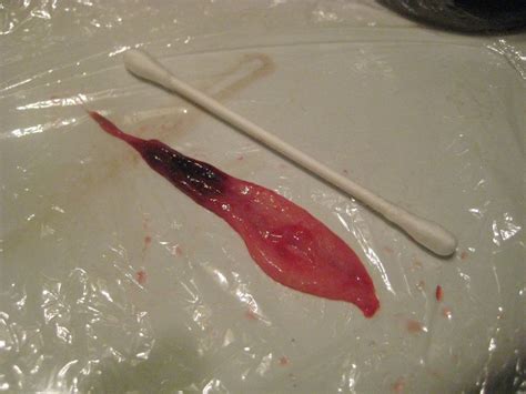Sep 10, 2019 · menstruation (menstrual cycle) is also referred to as a period. when a woman menstruates, the lining of the uterus is shed. Heavy cramping + white tissue during menstruation ...