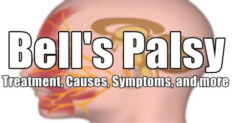 Bells Palsy Treatment Causes Symptoms And More About This Condition