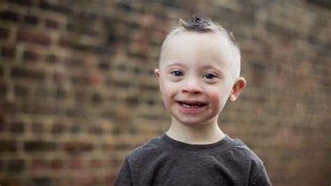 This 5 Year Old Model With Down Syndrome Is Melting Hearts With His