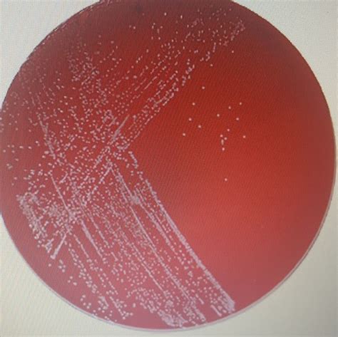 Solved This Is An Image Of An Inoculated Blood Agar Plate