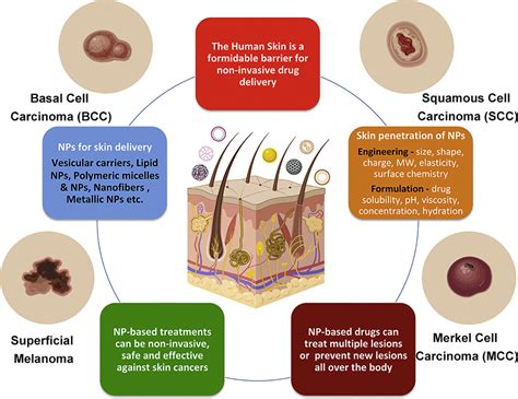 Cancer treatments may cause skin and nail changes. Nanoparticles for topical drug delivery: Potential for ...