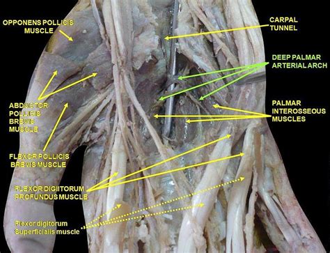 The palmar cutaneous nerve supplies sensation to the radial aspect of the palm and thenar eminence. Blood Supply to Hand - Hand - Orthobullets