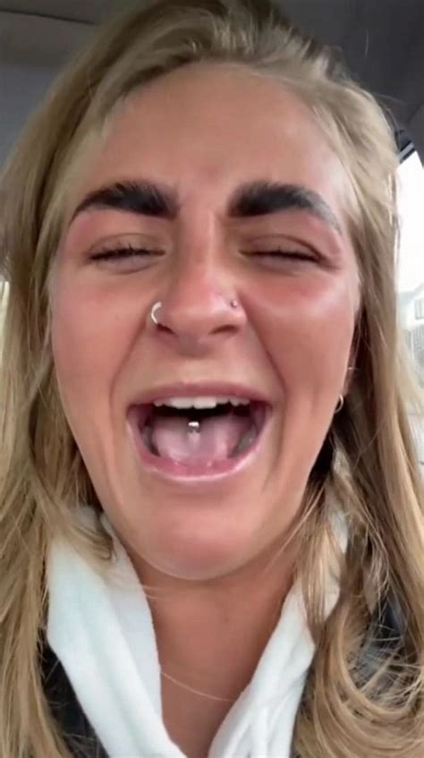 Woman Left Looking Like Mr Bean After Eyebrow Treatment Goes Disastrously Wrong Daily Star