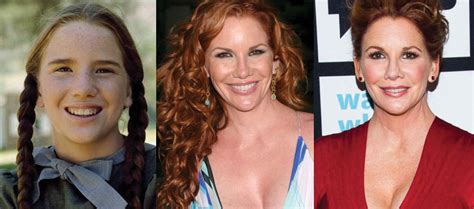 Browse 166 melissa gilbert children stock photos and images available, or start a new search to explore more stock photos and images. Melissa Gilbert Plastic Surgery Before and After Pictures 2020