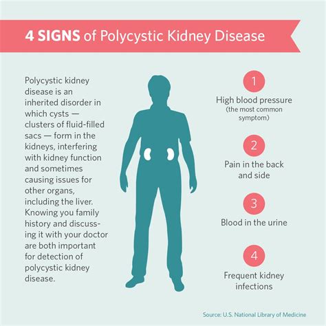 Symptoms Of Polycystic Kidney Disease