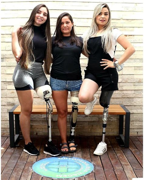 All Three Lost Their Left Legs In A Train Wreck In 2021 Amputee
