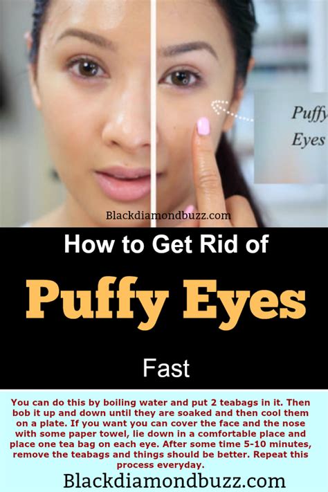 How To Get Rid Of Under Eyes Bags Naturally At Home