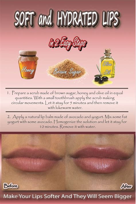 How To Get Soft And Hydrated Lips Naturally At Home Lip Hydration Soft Lips Skin So Soft