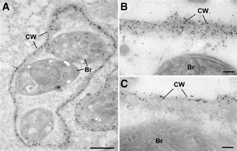 Bpk1 And Mcp4 Localize To The Cyst Wall Em Of Tissue Cysts Stained For