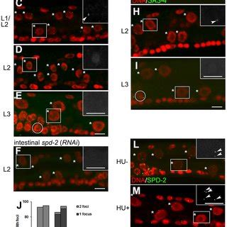 Check spelling or type a new query. (PDF) Centrosome/Cell Cycle Uncoupling and Elimination in ...
