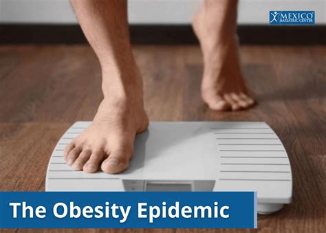 Obesity A Global Epidemic Dr Christian Rodriguez Lopez