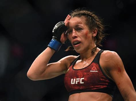 Joanna Jedrzejczyk To Have Surgery After Ufc Bout Left Her With Injured