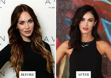 Scheana Shay Plastic Surgery Before And After